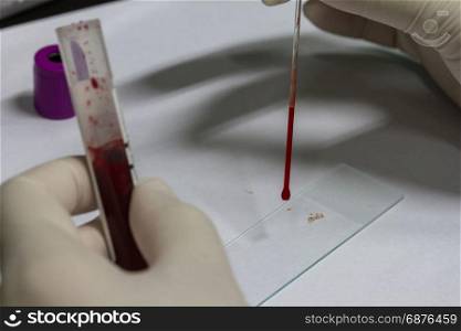 doctor will put a drop of blood on the sterile slide, medicine equipment and health concept
