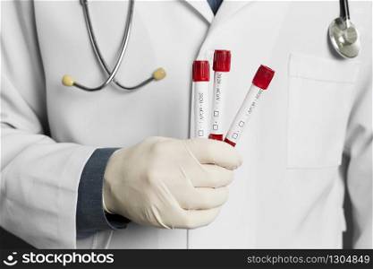 doctor with paper posing coronavirus alert