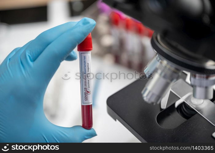 doctor working with blood sample in laboratory