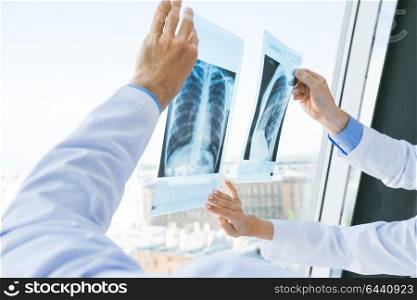 Doctors discuss x-ray. Group of doctors look and discuss x-ray in a clinic or hospital