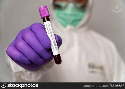 Doctors in the protective suits and masks are holding a positive blood test result for new rapidly outbreaking Coronavirus. Concept of spreading Coronavirus (COVID-19) around the world, USA, Europe