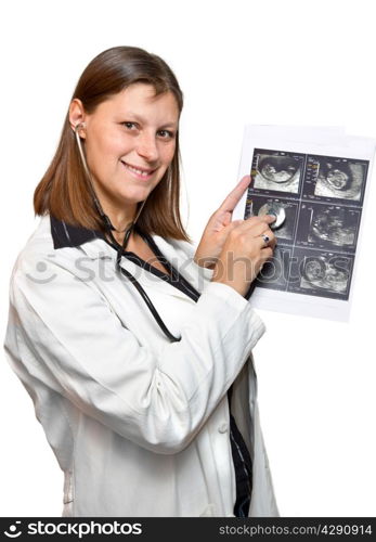 doctors looking at echography