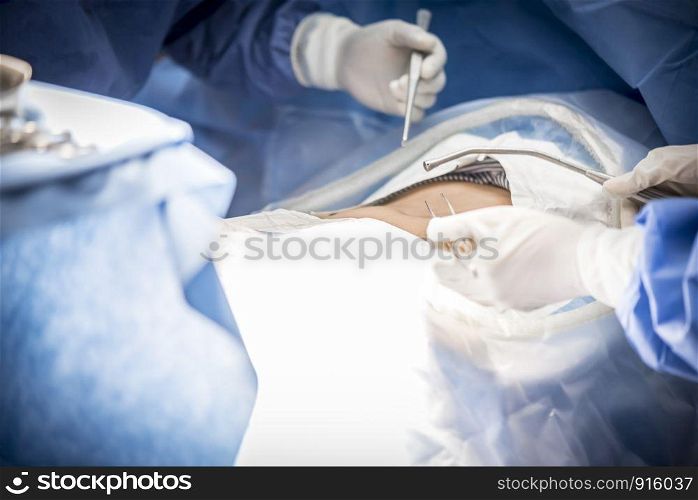 Doctors with tools in hands making surgery in operation room. Health care and Hospital concept