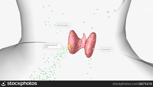 Due to their increased number of cells, enlarged parathyroid glands produce more parathyroid hormone than normal. 3D rendering. Due to their increased number of cells, enlarged parathyroid glands produce more parathyroid hormone than normal.