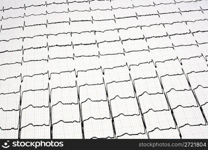 ECG - EKG graph