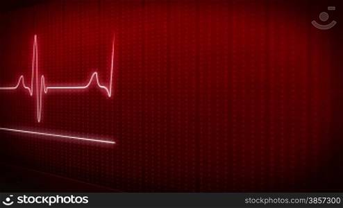 EKG electrocardiogram