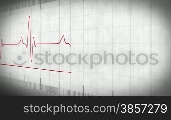 EKG electrocardiogram pulse real waveform on white paper