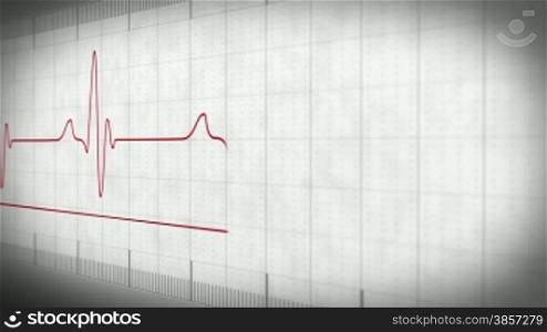 EKG electrocardiogram pulse real waveform on white paper