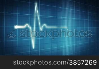 EKG electrocardiogram pulse trace