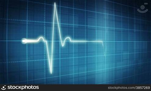 EKG electrocardiogram pulse trace