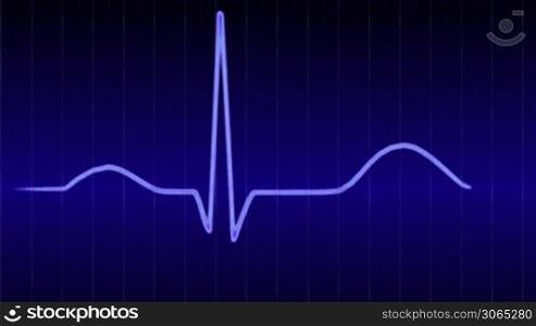 electrocardiogram of a human heartbeat, EKG - Elektrokardiogramm eines menschlichen Herzschlags