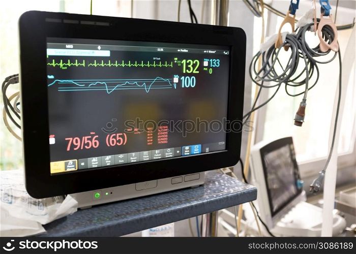 Electrocardiograph (ECG or EKG) unit in a hospital emergency room, black monitor screen showing heart rate & pulse,COVID-19 coronavirus USA pandemic healthcare crisis,high death toll & mortality rate