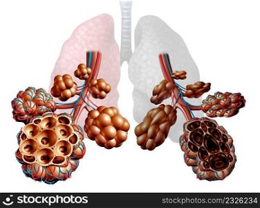 Emphysema as shortness of breath, lung disorder as a COPD illness and Chronic obstructive pulmonary disease medical concept as bronchioles and alveoli are damaged as a 3D illustration.