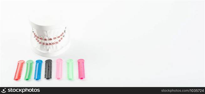 Example of orthodontic model made from white cement with braces and rubber in various colors for patients to choose from for beauty. With copy space area for slogan or text message.