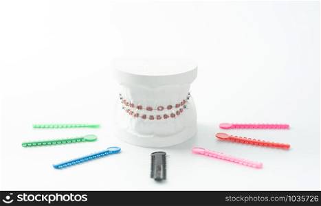 Example of orthodontic model made from white cement with braces and rubber in various colors for patients to choose from for beauty. With copy space area for slogan or text message.