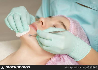 Facial cleansing. Blackhead Removal Tool. Beautician removing blackhead and acne on female chin in a beauty salon. Beautician removing blackhead and acne