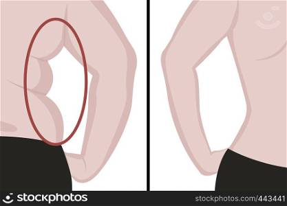 Fat and slim girl's back. Fat waist. Liposuction. Before and after. Woman body correction vector illustration