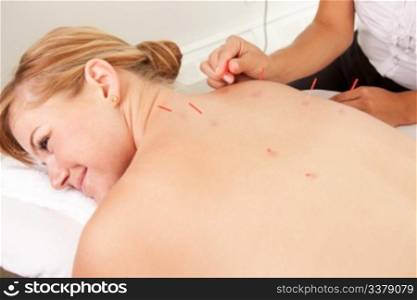 Female acupuncturist stimulating needles in the Back Shu acupuncture points