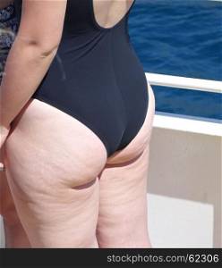 female body with cellulite