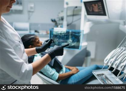 Female dentist shows problem on x-ray picture, dental clinic, patient in chair on background. Woman in dentistry cabinet, stomatology, teeth care. Female dentist shows problem on x-ray picture
