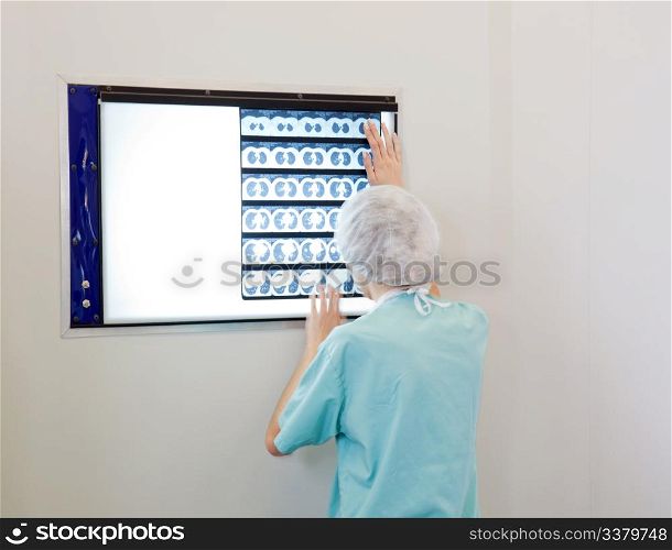 Female doctor examining an X-Ray image of patient