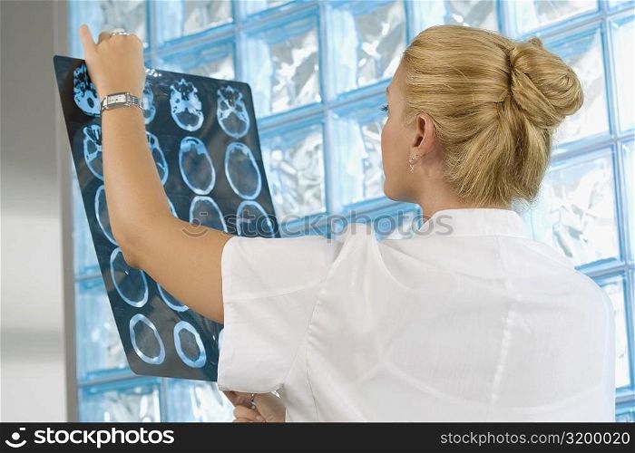Female doctor examining an X-Ray report