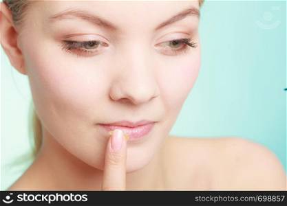 Female putting applying lip balm moisturizing balsam. Girl taking care of lips. Skincare.. woman applying balsam for lips