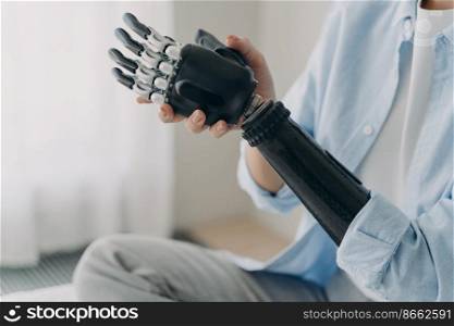 Female with disability putting together her bionic prosthetic arm, close up. Disabled woman training to use artificial robotic limb. Advertising of high tech myoelectric prosthesis.. Person with disability puts together bionic prosthetic arm. Ad of high tech myoelectric prosthesis