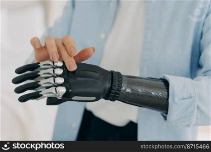 Female with disability touches, customizes her high tech artificial arm limb, close up. Disabled caucasian girl showing bionic hand sensory prosthesis. Medical technologies concept.. Disabled female touches high tech artificial arm limb, close up. Bionic hand prosthesis advertising