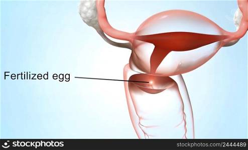 Fertilization happens when a sperm cell successfully meets an egg cell in the fallopian tube. 3d illustration. Fertilization happens when a sperm cell successfully meets an egg cell in the fallopian tube.