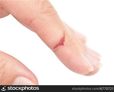 Flesh wound with blood on female finger isolated on white