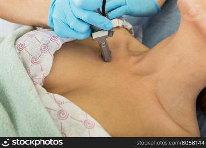 fractional laser rejuvenation. fractional laser rejuvenation of neckline area for women