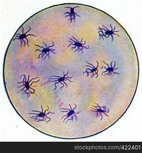 Germs of typhoid fever, vintage engraved illustration.