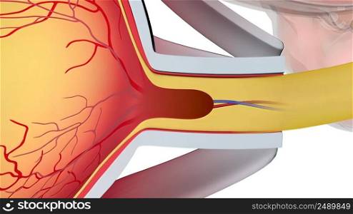 Glaucoma is a group of eye conditions that damage the optic nerve, the health of which is vital for good vision. 3D illustration. Glaucoma is an eye condition that damages the optic nerve, which is vital for good vision.