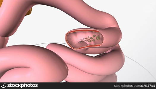 Glucose is the body primary source of fuel and is either converted into energy within cells 3D rendering. Glucose is the body primary source of fuel and is either converted into energy within cells