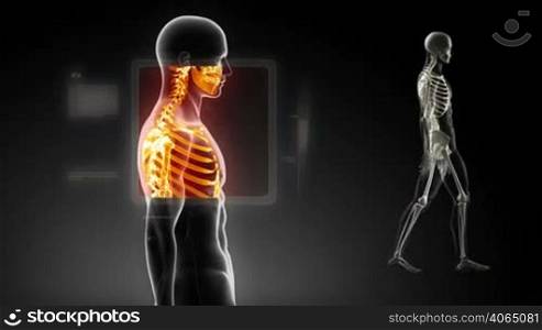 Good posture concept &#8211; x-ray spine scan