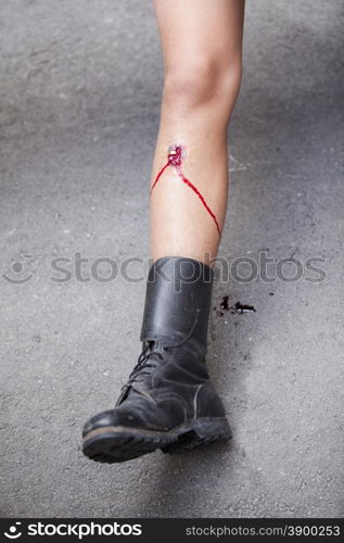 Gunshot wound on the soldier leg