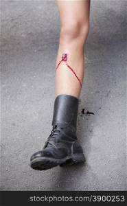 Gunshot wound on the soldier leg