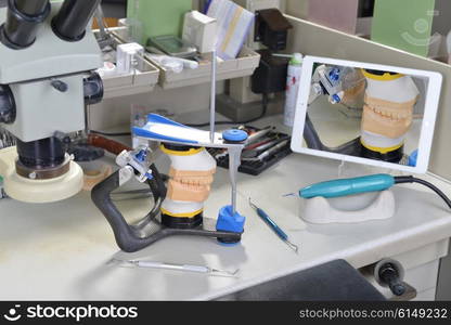 gypsum model of jaw and basic dentist tools