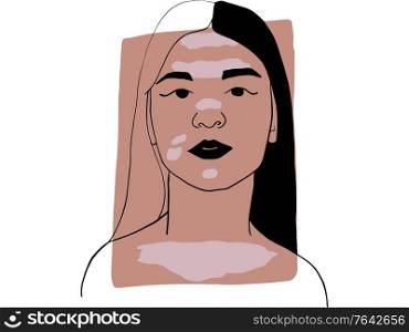 Hand-draw outline portrait of a young woman with vitiligo and dark beige sample color. Abstract colletion of different people and skin tones. Diversity concept