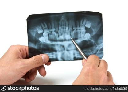 hand holds radiograph isolated on a white background