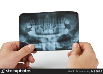 hand holds radiograph isolated on a white background