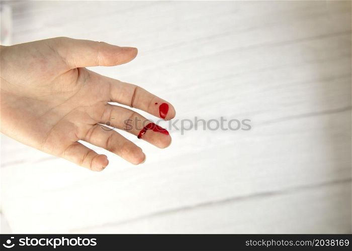 hand injury with blood, blood wound cut top view, copy space, medical concept needs stitches space for text. hand injury with blood, blood wound cut top view, copy space, medical concept needs stitches