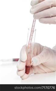 Hand of laboratory assistant holding test tube with blood sample on white background.