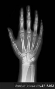 hand on x-ray negative film