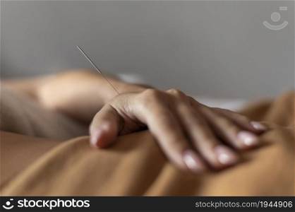 hand with acupuncture needle. High resolution photo. hand with acupuncture needle