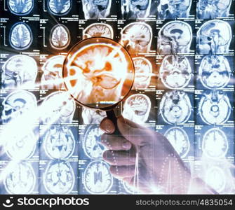 Hand with magnifier. Close up of human hand holding magnifier examining x-ray results