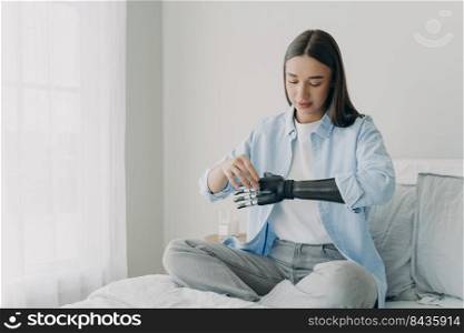 Handicapped young woman setting bionic nerve control prosthesis parameters. Bionic hand has processor chip and buttons. European girl adjusting her artificial arm. Innovation development.. Handicapped young woman setting nerve control prosthesis parameters. Bionic artificial arm.