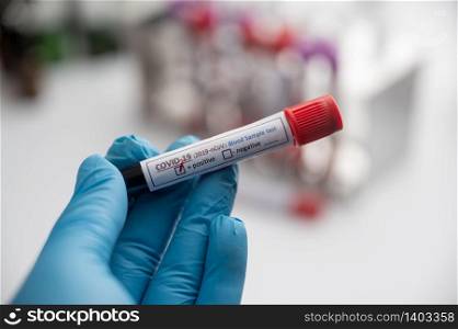 hands of a lab technician with a tube of blood sample and a rack with other samples / lab technician holding blood tube sample for study