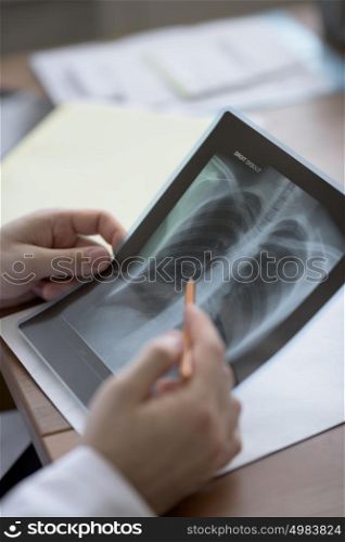 Hands of doctor holding chest and lungs xray in medical office